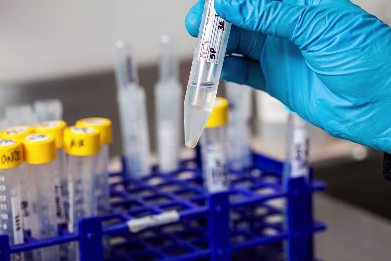 Test tube with blood cells pellet obtained after several washes and centrifugation.