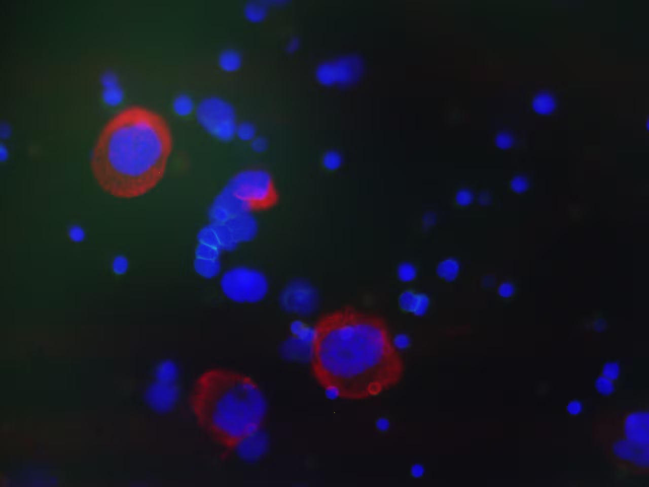 Immunofluorescence - Circulating tumor cells