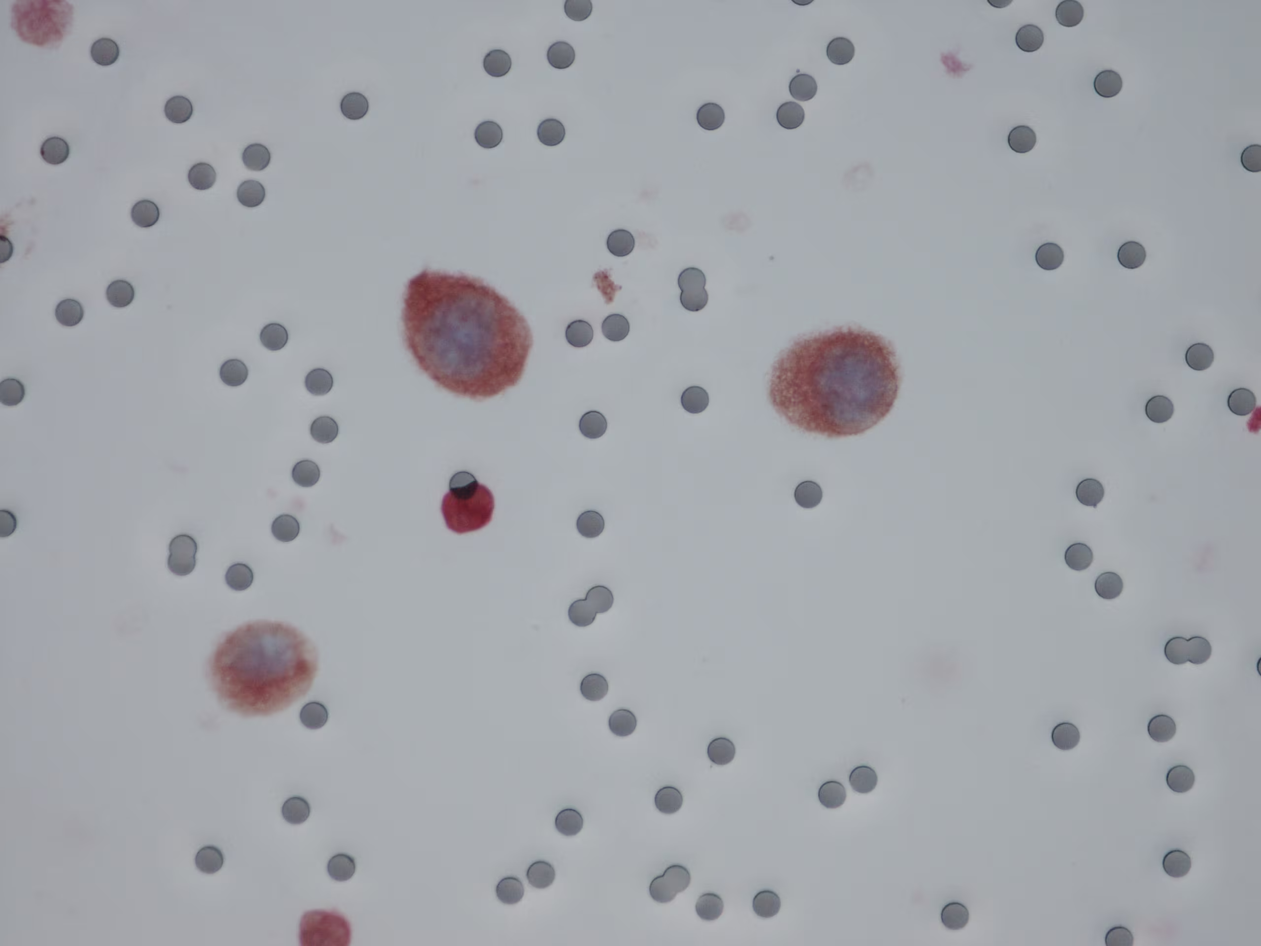 21AA1857-grosse-cellule-DABRED-02062022-photo2