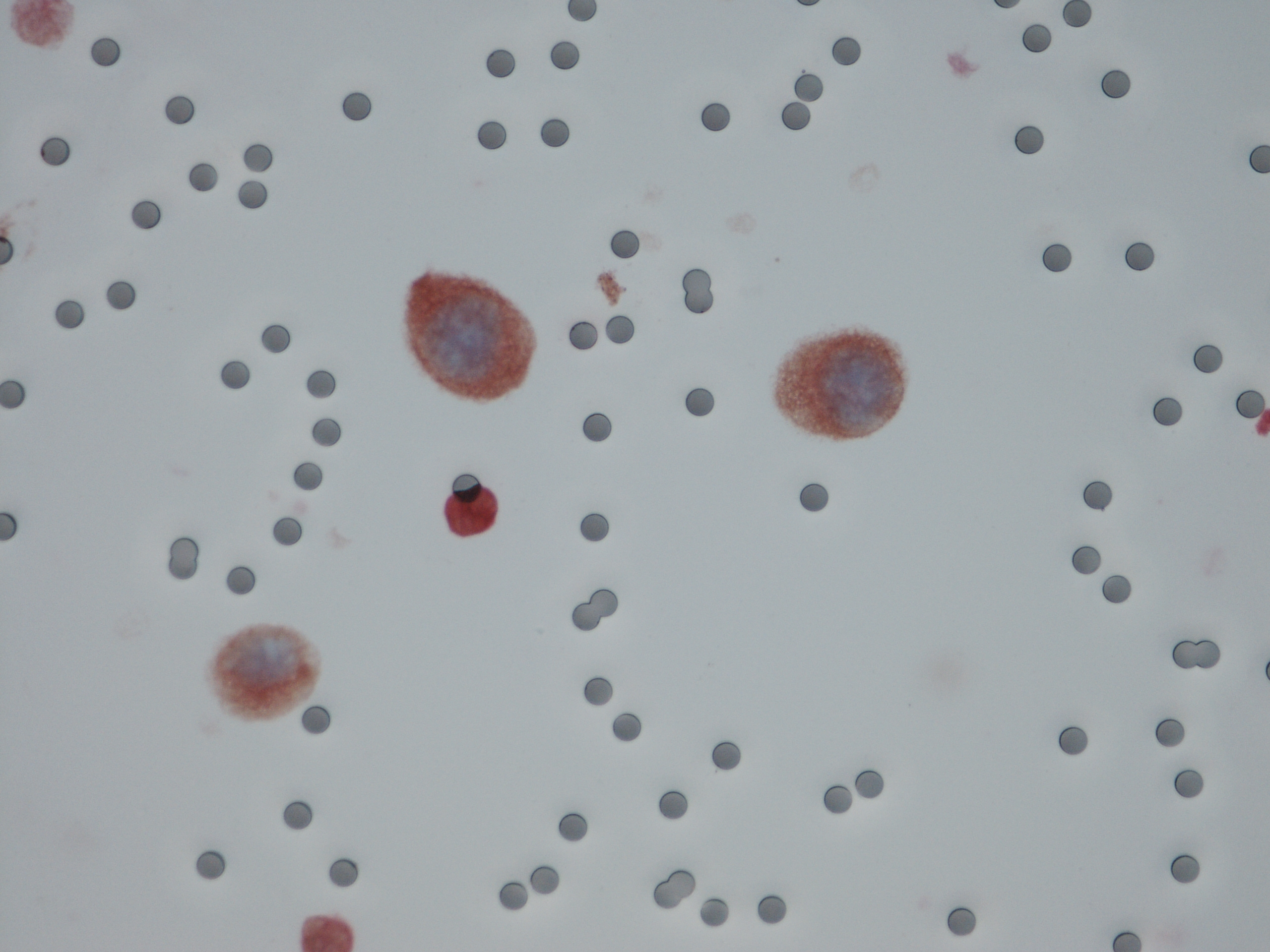 21AA1857 grosse cellule DAB+RED+ 02062022 photo2