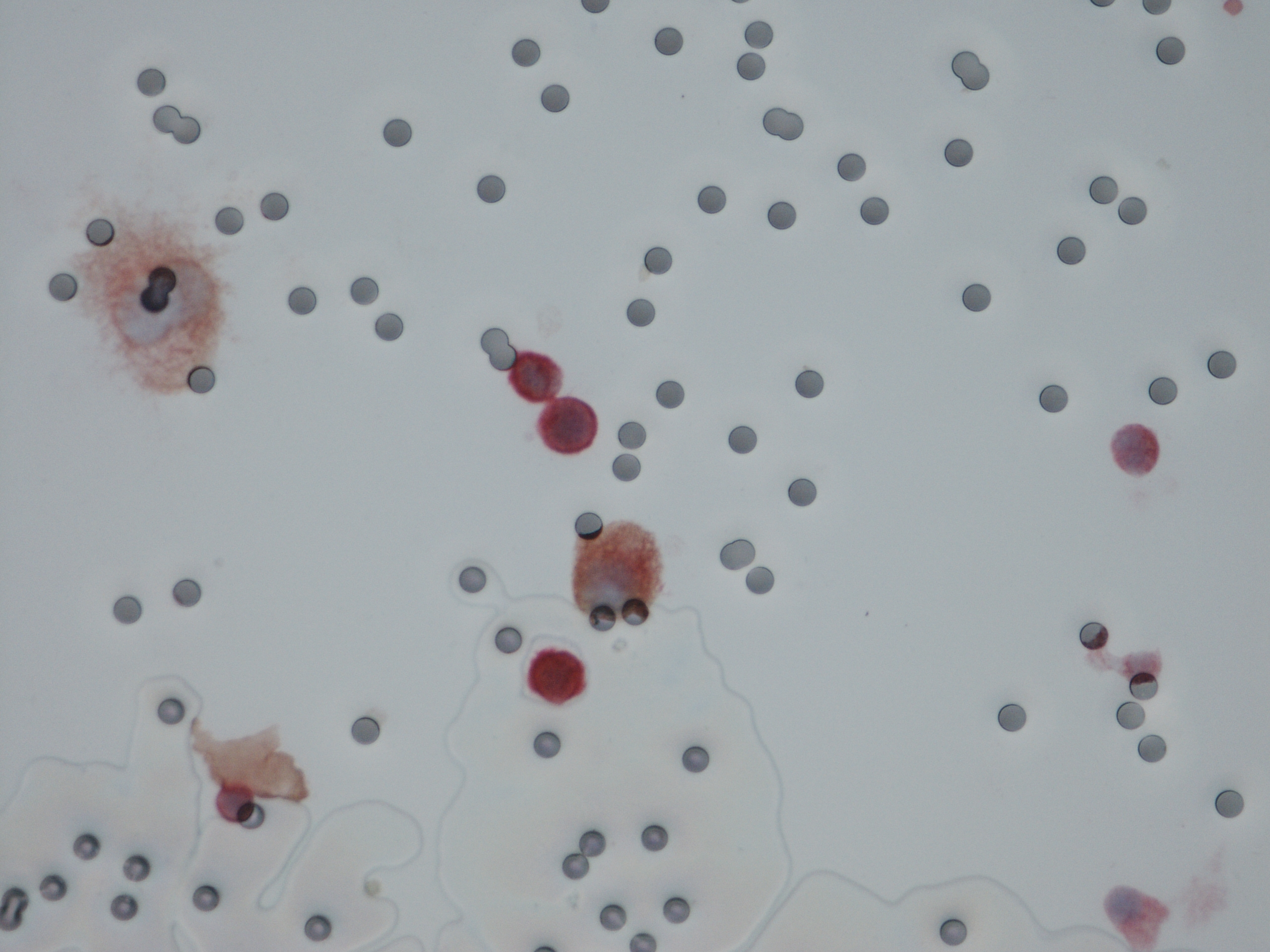 21AA1857 grosse cellule DAB+RED+ 02062022
