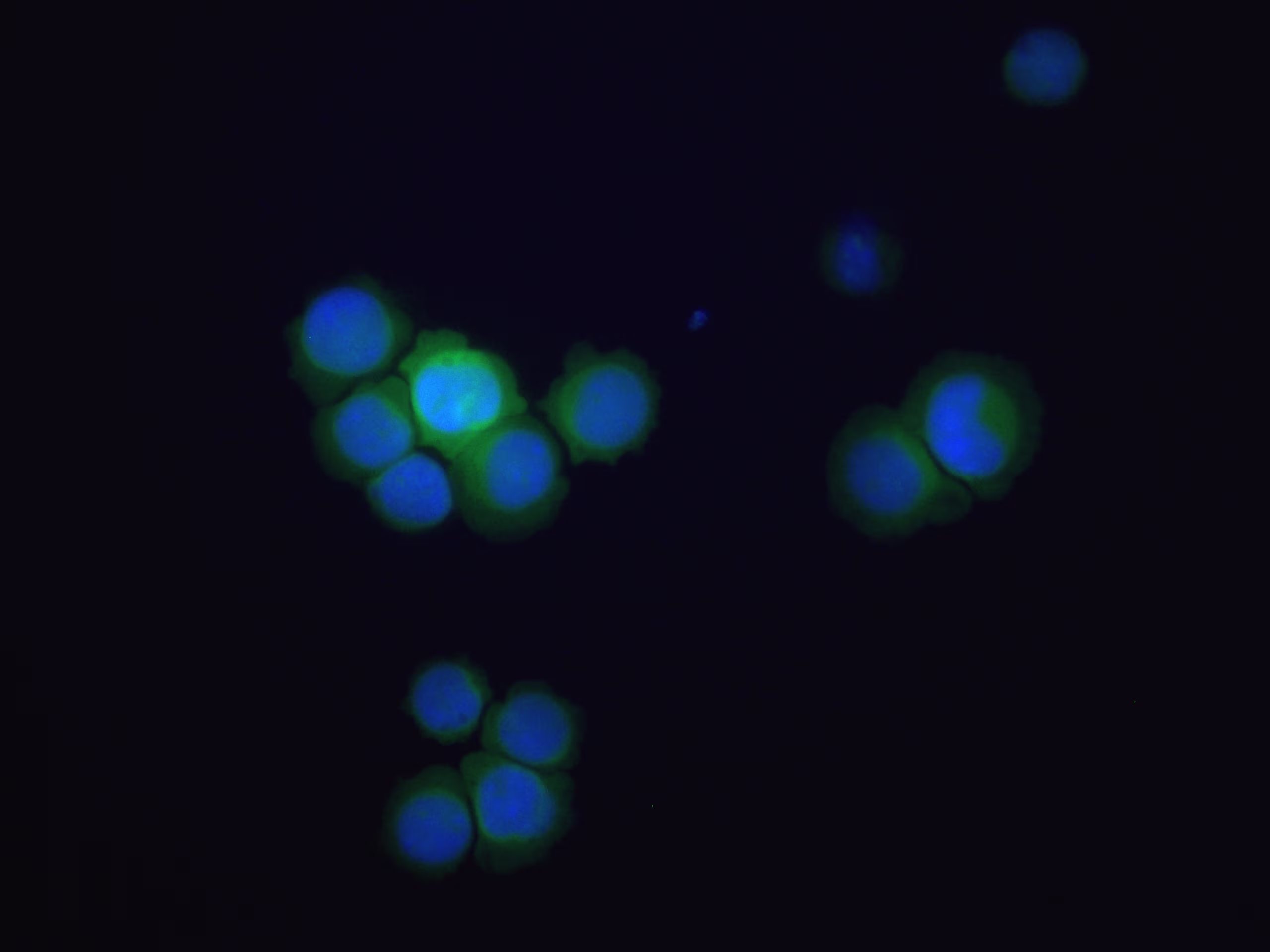 IF circulating tumor cells